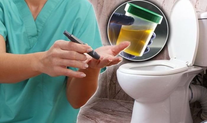 Pada penderita diabetes melitus urine mengandung