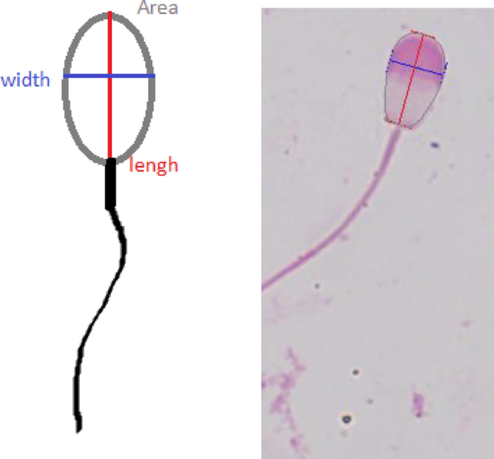 Sperm abnormalities photomicrographs