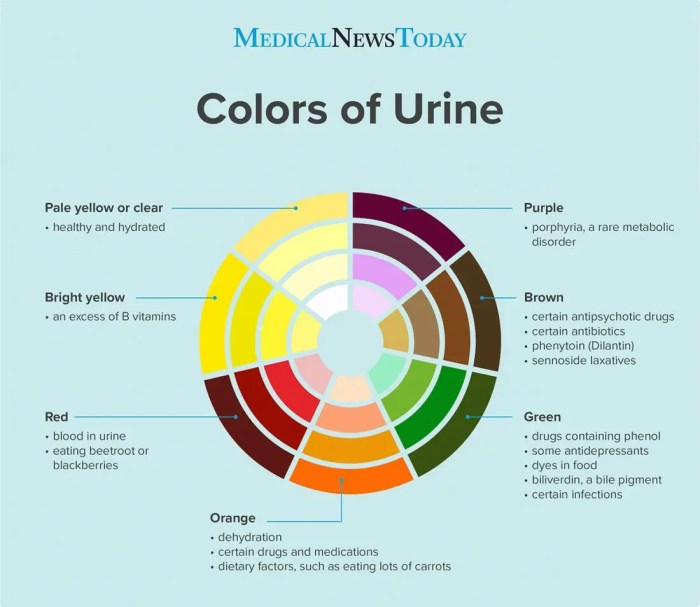 Pee health color what urine says meaning colour healthy chart yellow means things should cbn abs know first remedies information