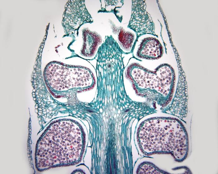 Mengapa lycopodium sp disebut sebagai paku kawat