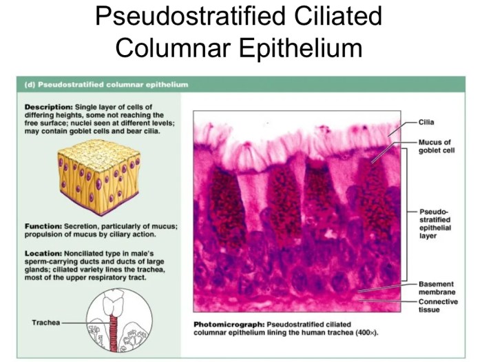 Epitel silindris berlapis semu